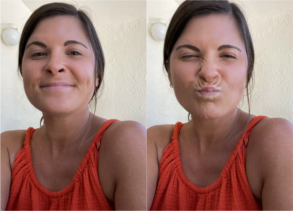 My First Botox Experience At 30